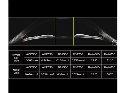 16mm angle-to-angle analysis