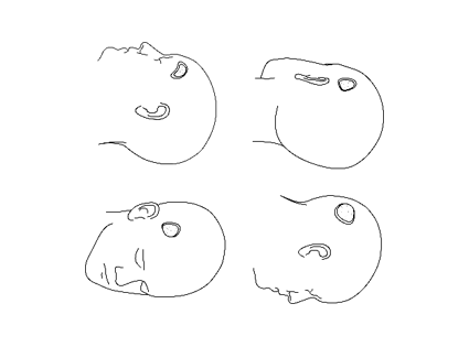 Advanced Registration Algorithms