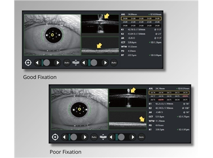 Automatic real-time fixation check