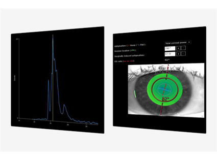 Cataract App