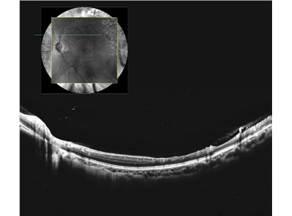 Comprehensive clarity with 12x12 mm 3D PanoScan