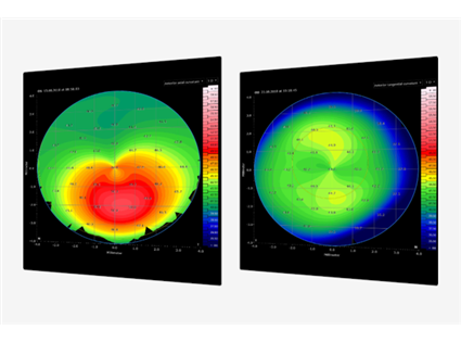 Cornea App