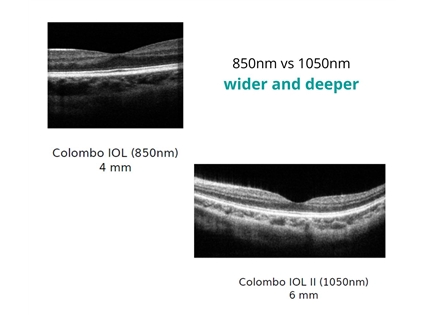 Excellent Cataract Penetration