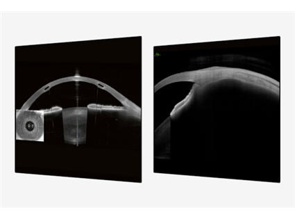 Imaging App