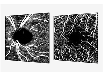 OCT Angiography Module