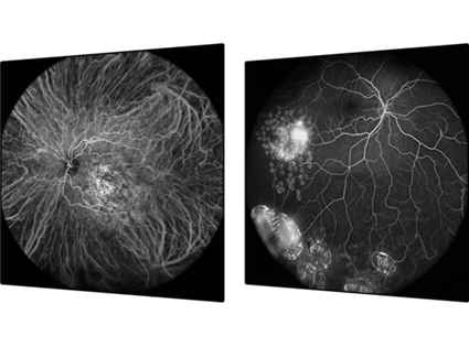 Ultra-Widefield Imaging Module