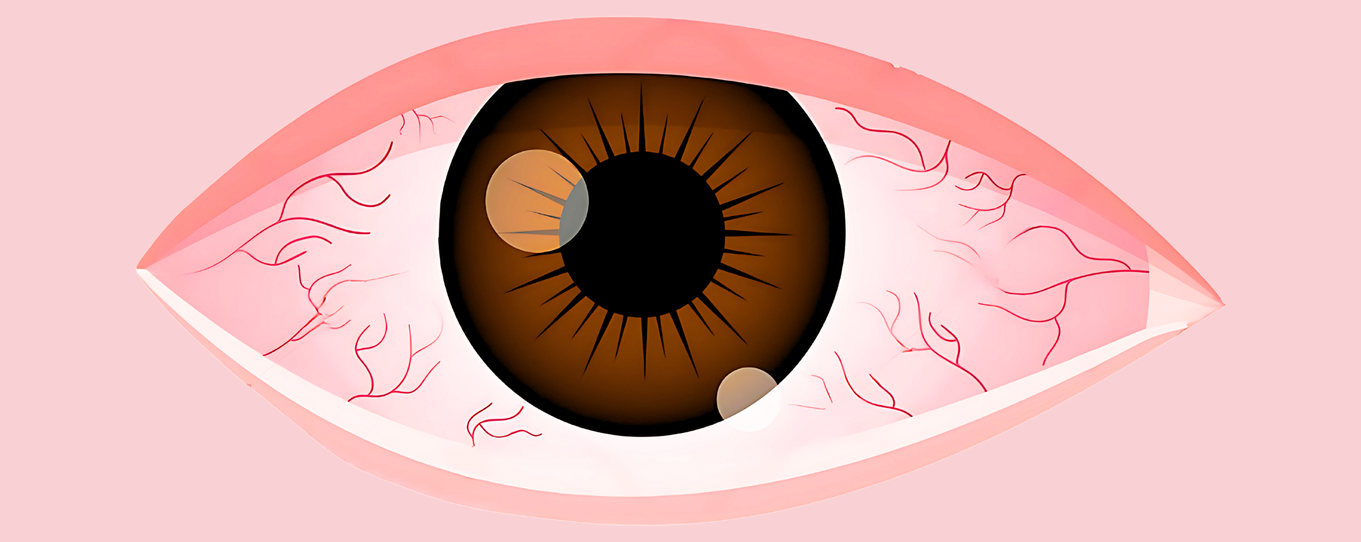 Dry Eye Screening & Treatment System