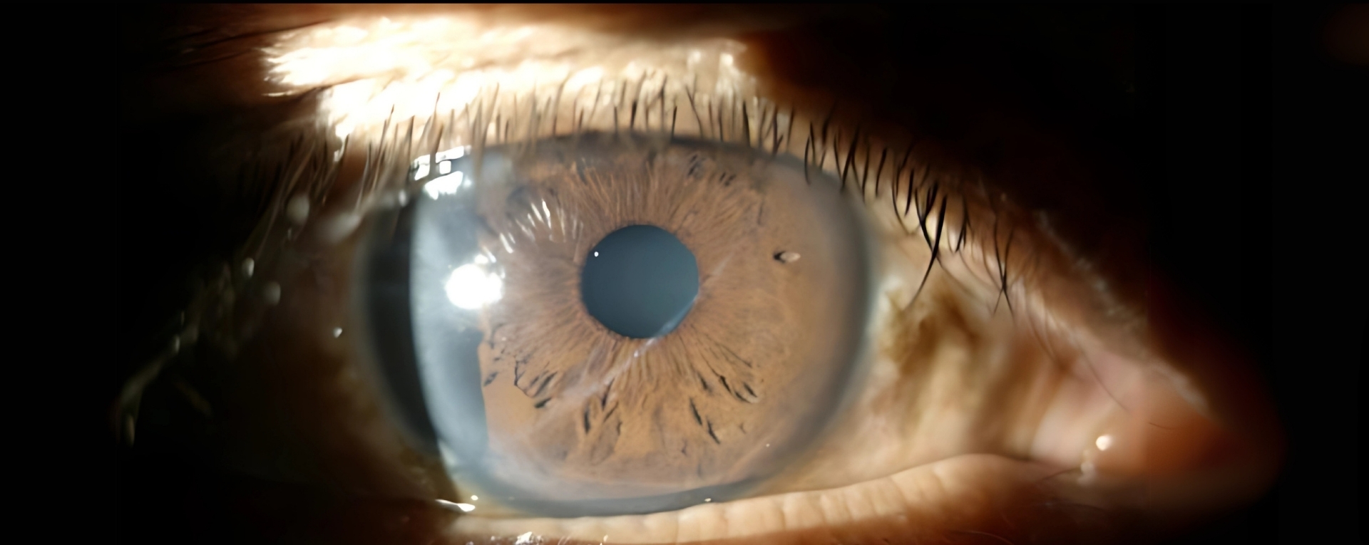 General Ophthalmic Diagnostics & Examination