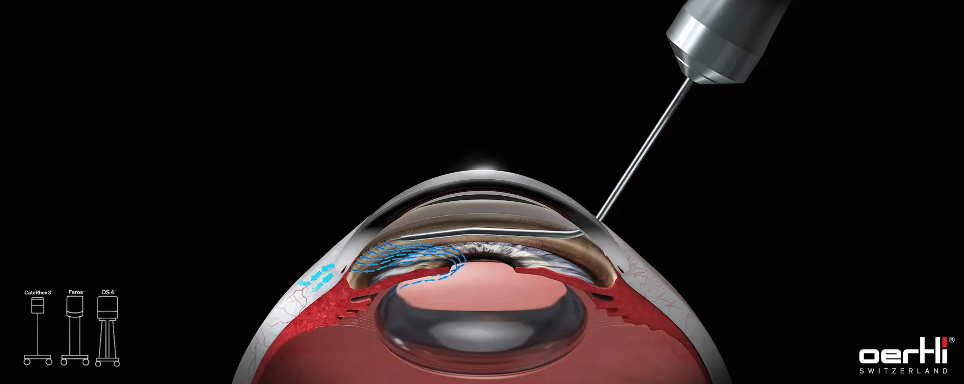 Phacoemulsification & Vitrectomy Systems