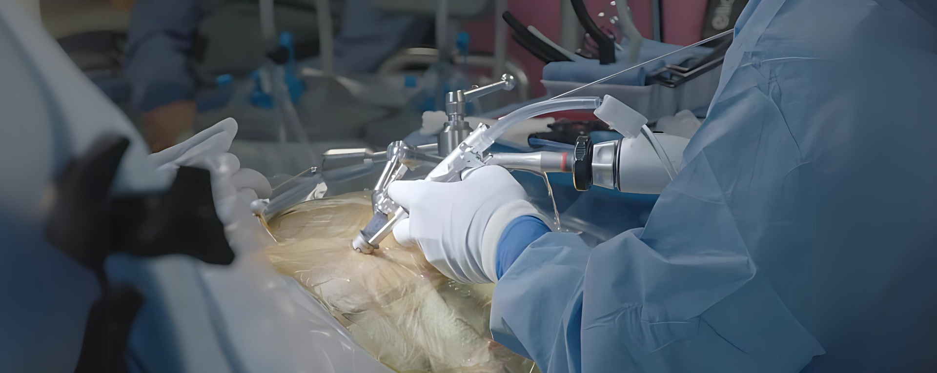 Ultrasonic Surgical Aspirators