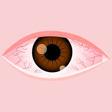 Dry Eye Screening & Treatment System