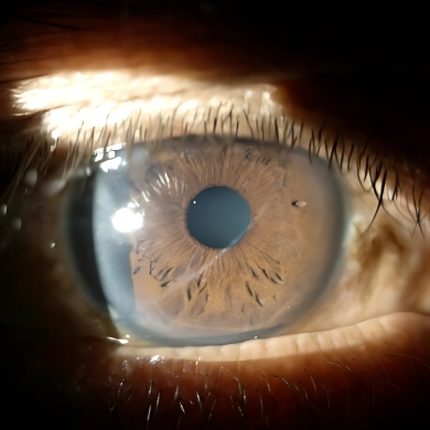 General Ophthalmic Diagnostics & Examination